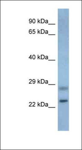 Anti-NEUROG3 antibody produced in rabbit