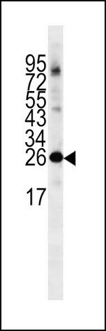 Anti-NCS1 (center) antibody produced in rabbit