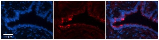 Anti-NETO2 (ab1) antibody produced in rabbit