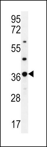 ANTI-OR4M1 (C-TERM) antibody produced in rabbit