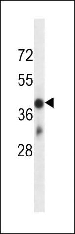 ANTI-OR4D6 (C-TERM) antibody produced in rabbit