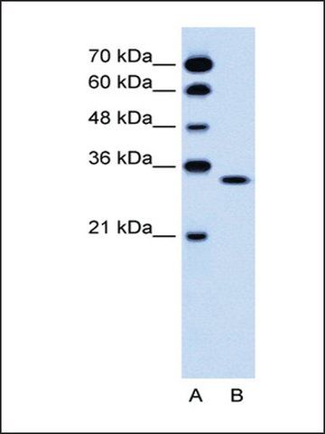 Anti-OR5T2 antibody produced in rabbit