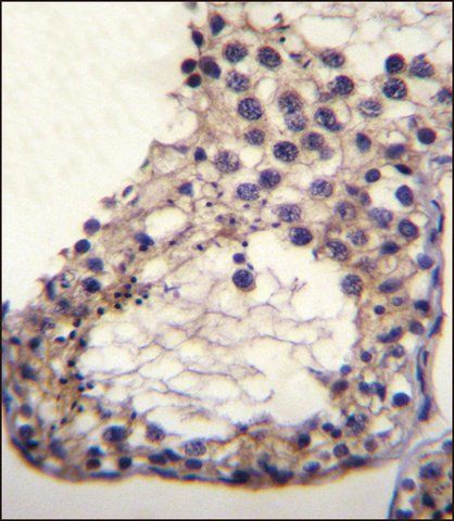 ANTI-OTOA (N-TERM) antibody produced in rabbit