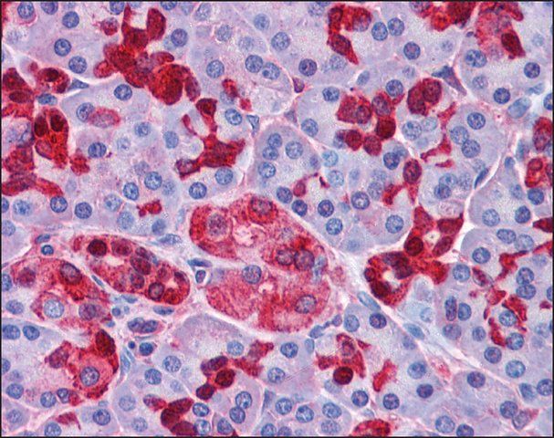Anti-OTUD4 antibody produced in rabbit