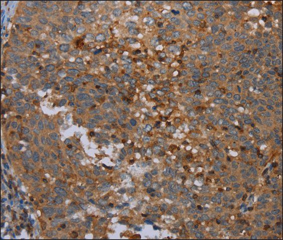 Anti-OTOR antibody produced in rabbit