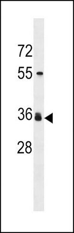 ANTI-ORNT2 (CENTER) antibody produced in rabbit