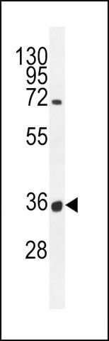 ANTI-OR7G1 (N-TERM) antibody produced in rabbit