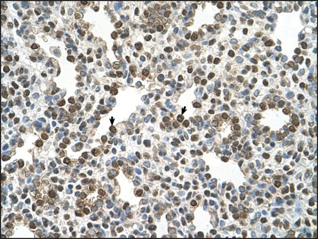 Anti-OSBPL9 antibody produced in rabbit