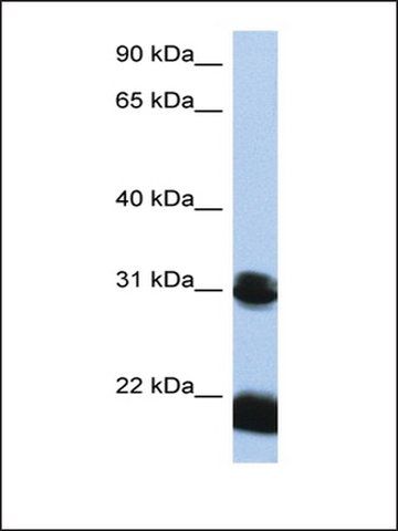 Anti-OTX1 (AB2) antibody produced in rabbit
