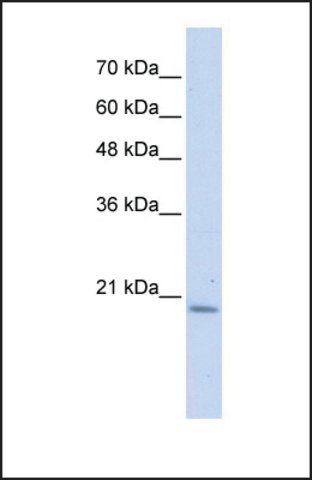 Anti-PFDN6, (N-terminal) antibody produced in rabbit