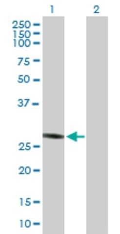 Anti-PGLS antibody produced in mouse