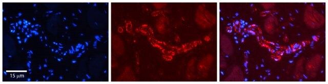 Anti-PHF1 (AB2) antibody produced in rabbit