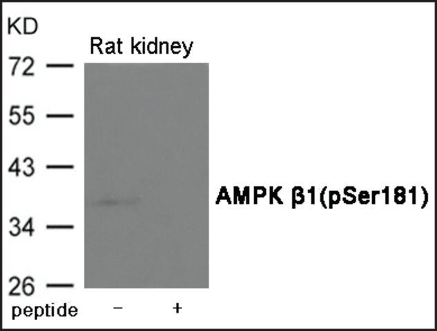 Anti-phospho-AMPK β1 (pSer<sup>181</sup>) antibody produced in rabbit