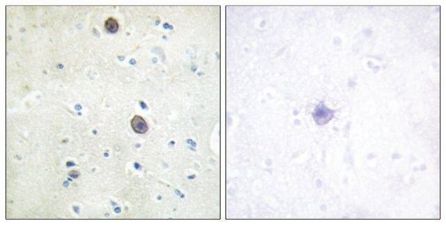 Anti-phospho-Amyloid β A4 (pThr<sup>743/668</sup>) antibody produced in rabbit