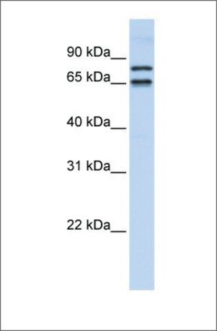 Anti-PHF20L1 antibody produced in rabbit