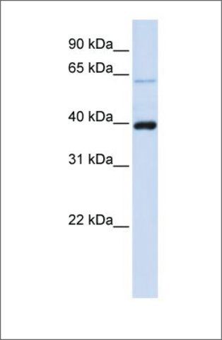 Anti-PHF6 antibody produced in rabbit