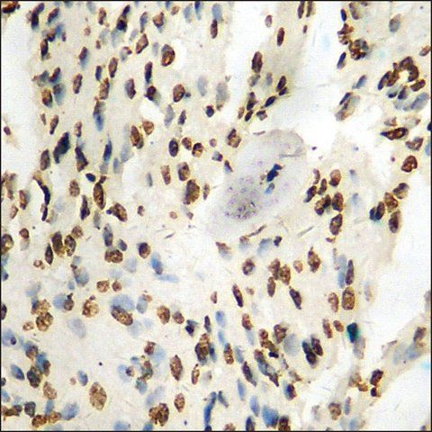 Anti-phospho-AIRE (pSer<sup>156</sup>) antibody produced in rabbit