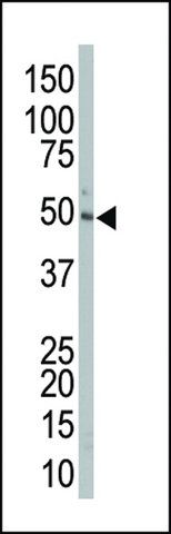ANTI-MEK2 (MAP2K2) (CENTER) antibody produced in rabbit
