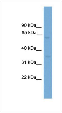 Anti-MFSD8 antibody produced in rabbit