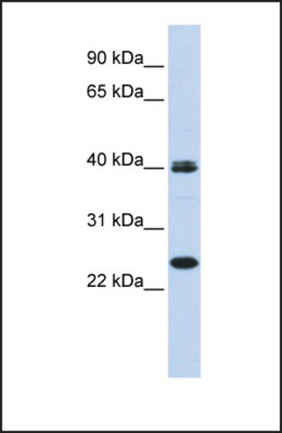 Anti-MESP1, (N-terminal) antibody produced in rabbit