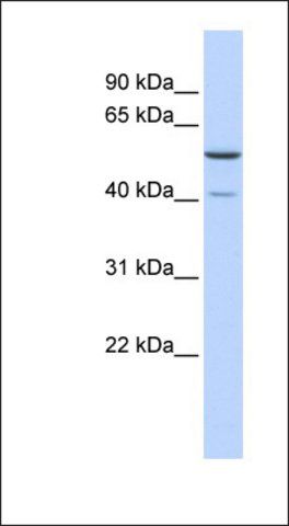 Anti-METT5D1 antibody produced in rabbit