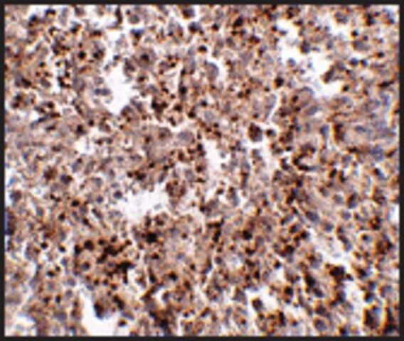 Anti-METTL7B (ab1) antibody produced in rabbit