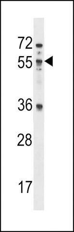 ANTI-MEX3B(N-TERMINAL) antibody produced in rabbit