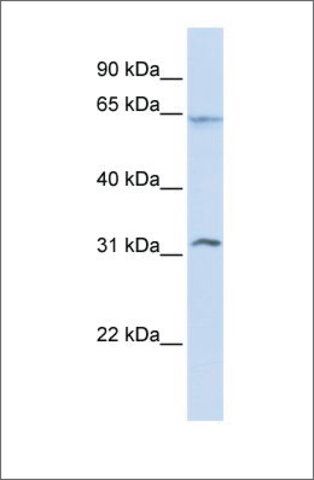 Anti-METT10D (ab2) antibody produced in rabbit