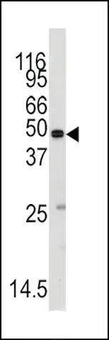 ANTI-METHIONYL TRNA SYNTHETASE(C-TERMINAL) antibody produced in rabbit