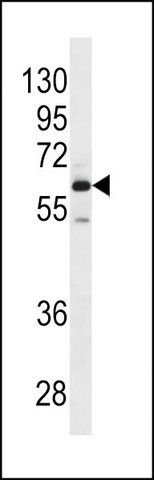 ANTI-MEPE (N-TERM) antibody produced in rabbit