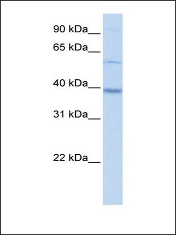 Anti-METTL2B (AB2) antibody produced in rabbit