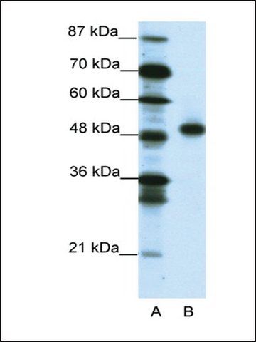 Anti-MEOX2 (AB3) antibody produced in rabbit
