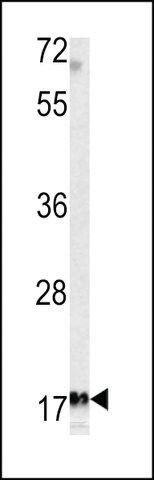 ANTI-MFAP5(C-TERMINAL) antibody produced in rabbit