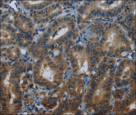 Anti-MEI1 antibody produced in rabbit