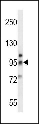 ANTI-METABOTROPIC GLUTAMATE RECEPTOR 6 (GPRC1F)(C-TERMINAL) antibody produced in rabbit