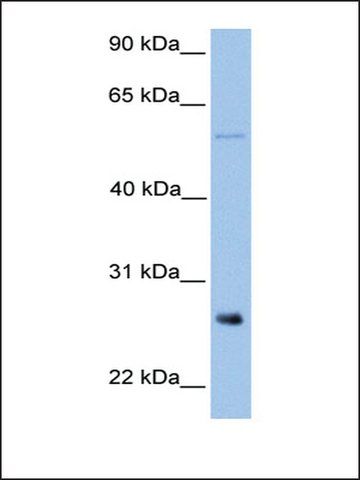 Anti-METTL7B antibody produced in rabbit