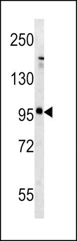 ANTI-METABOTROPIC GLUTAMATE RECEPTOR 5 (GPRC1E) (C-TERM T1003) antibody produced in rabbit