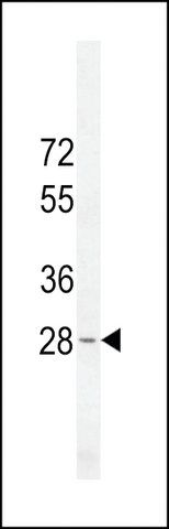 ANTI-METTL10(N-TERMINAL) antibody produced in rabbit