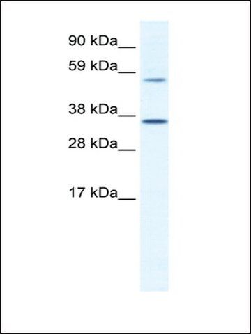 Anti-MESP2 antibody produced in rabbit