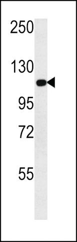 ANTI-METABOTROPIC GLUTAMATE RECEPTOR 3(C-TERMINAL) antibody produced in rabbit