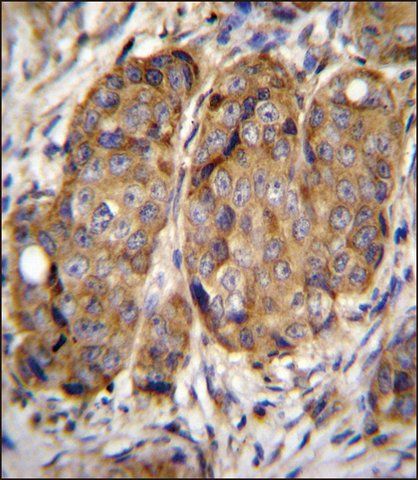 ANTI-METTL2 (C-TERM) antibody produced in rabbit