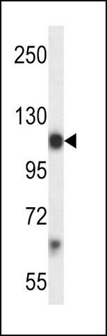 ANTI-MOUSE PDGFRA (CENTER) antibody produced in rabbit