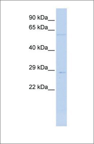 Anti-MRPL10 antibody produced in rabbit