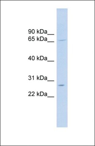 Anti-MRPL13 antibody produced in rabbit