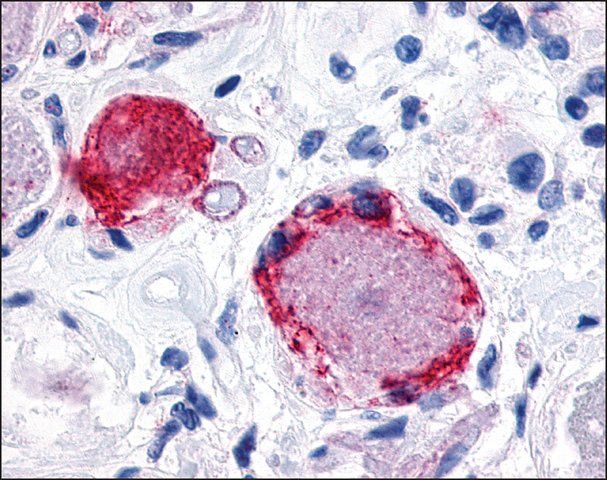 Anti-MRGPRX3 / MRGX3 antibody produced in rabbit