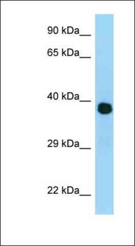 Anti-MRPL3 antibody produced in rabbit