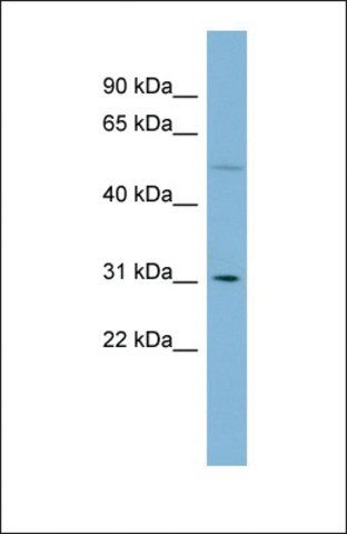 Anti-MRPL28 antibody produced in rabbit