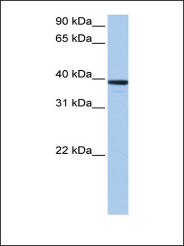 Anti-MRM1 antibody produced in rabbit
