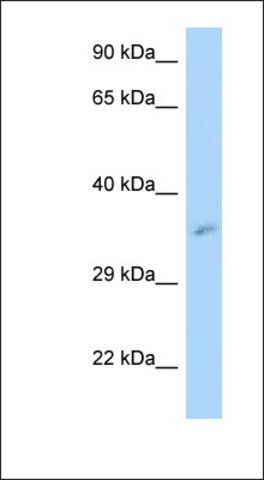 Anti-MRPL3 antibody produced in rabbit