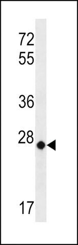 ANTI-MT-CO3(N-TERMINAL) antibody produced in rabbit